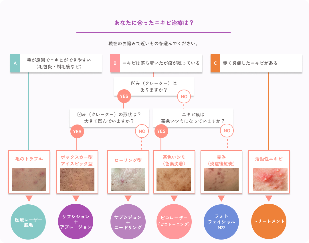 あなたに合ったニキビ治療フローチャート