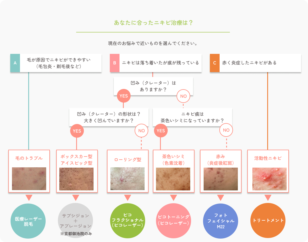 あなたに合ったニキビ治療フローチャート