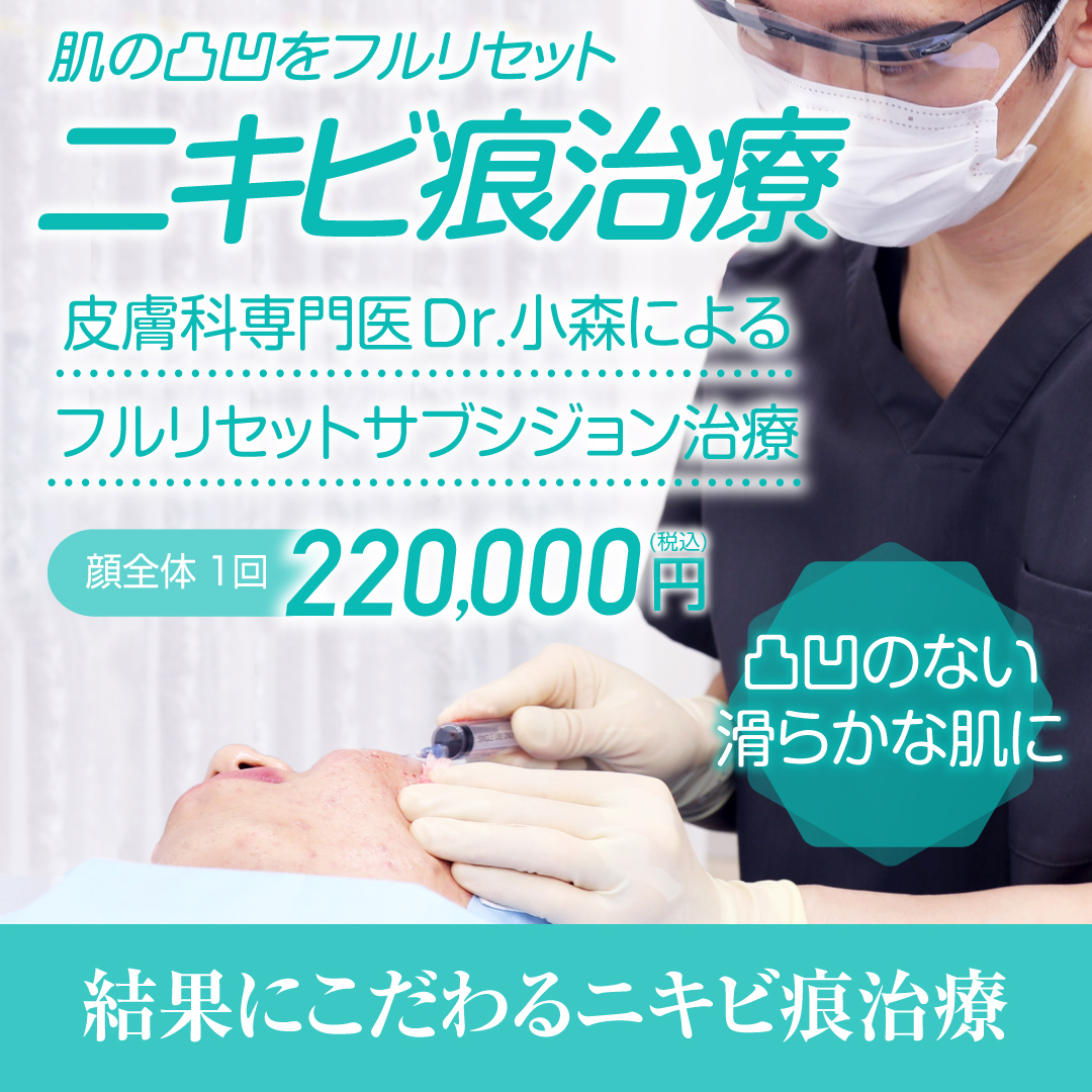 サブシジョン治療