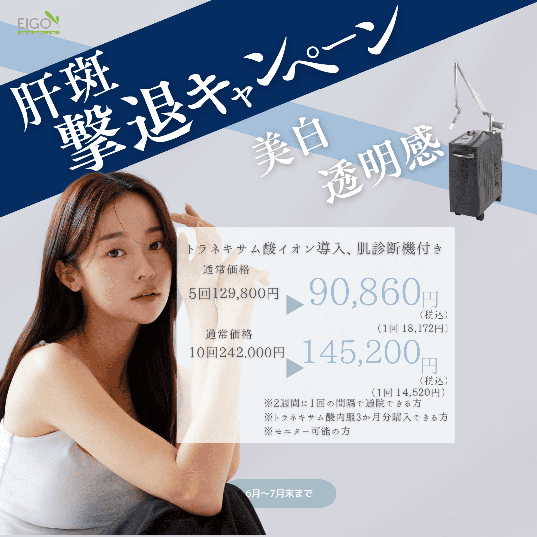 肝斑撃退キャンペーン