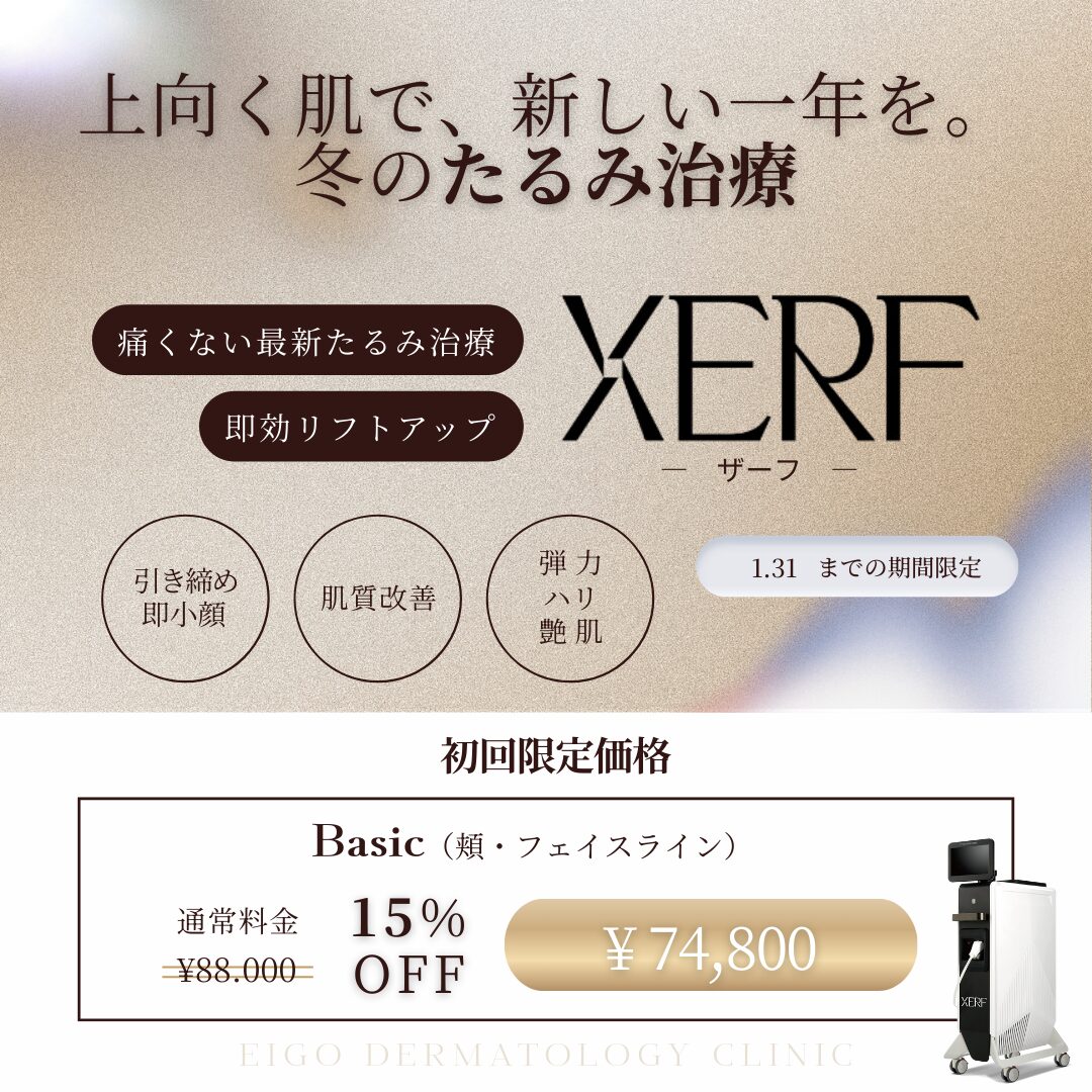 XERF