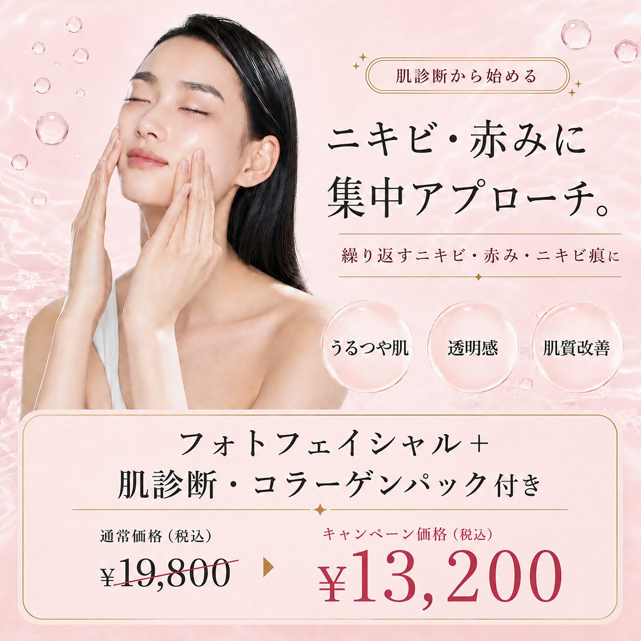 【奈良院限定】肌診断から始める、ニキビ・赤みに集中アプローチ。フォトフェイシャル＋肌診断・コラーゲンパック付き