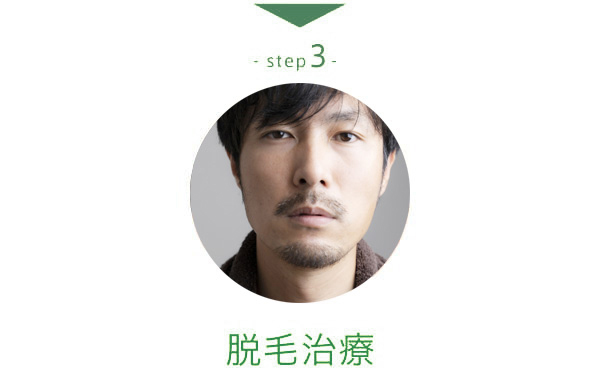 step4 脱毛治療